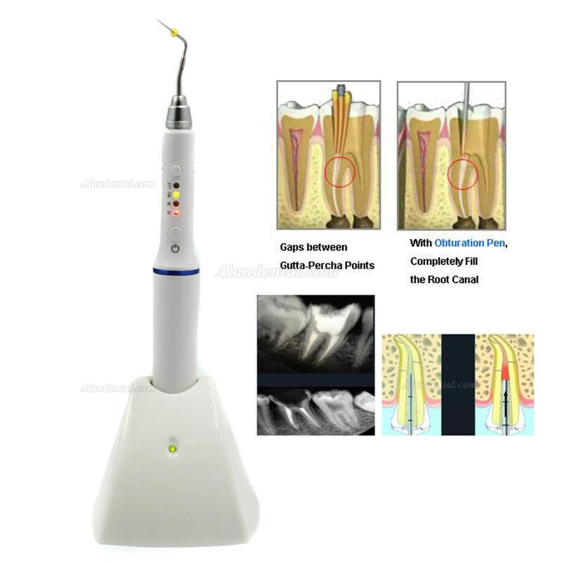 Wireless Dental Gutta Percha Obturation System Endo Heated Pen